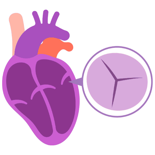 Valvular Heart Disease Treatment | Krystle By Batra's Clinic | Dr. Navida Batra Valvular Heart Disease Treatment | Krystle By Batra's Clinic | Dr. Navida Batra | Best Interventional Cardiologist in Delhi NCR