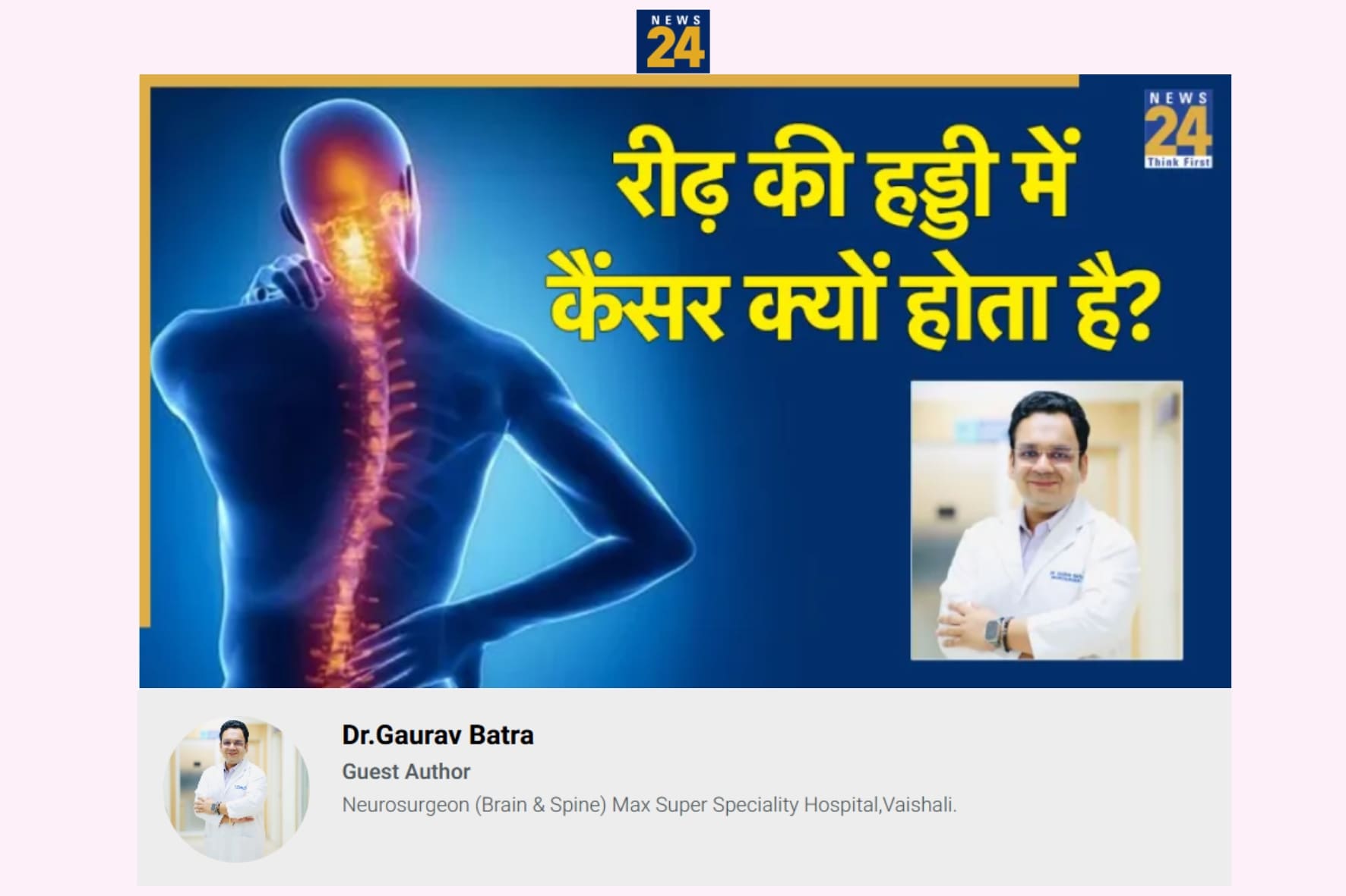 Dr. Gaurav Batra Neurosurgeon Media Coverage News 24 | Best Neurosurgeon For Brain and Spine in Delhi NCR