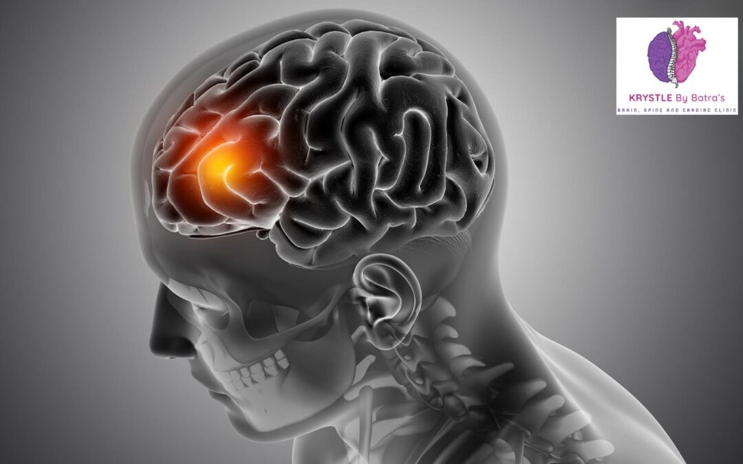 Brain Tumor Treatment