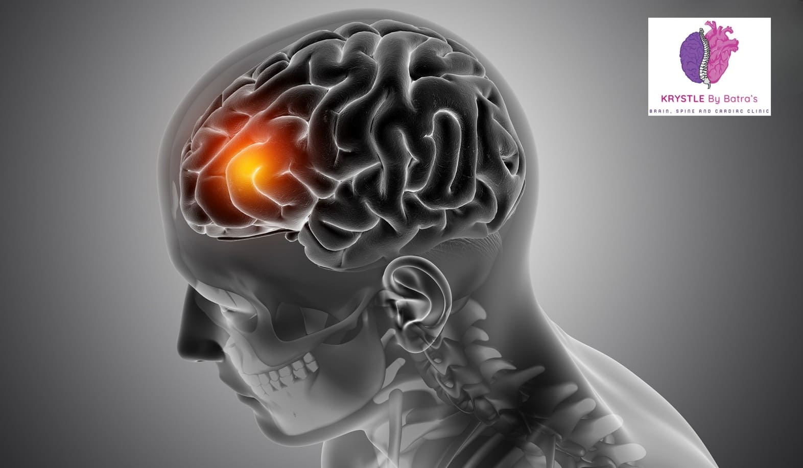 Best Brain Tumors Treatment in Delhi NCR - Dr. Gaurav Batra | Best Neurosurgeon in Delhi NCR | Krystle By Batra's Clinic