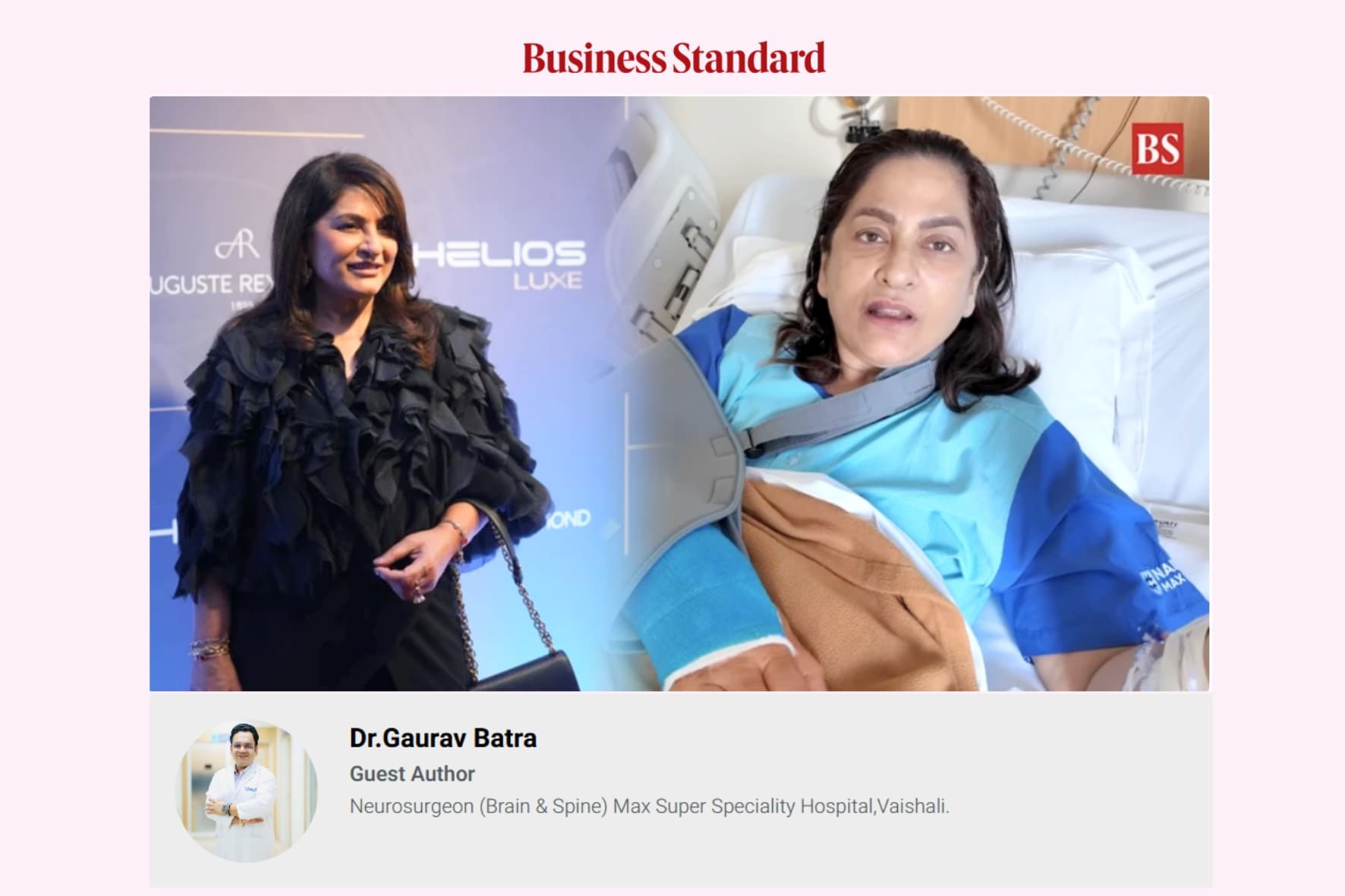 Dr. Gaurav Batra Neurosurgeon Media Coverage business standard | Best Neurosurgeon For Brain and Spine in Delhi NCR