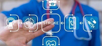 Cardiologist,Working,On,Virtual,Touch,Screen,Presses,Word:,Stroke.,Stroke